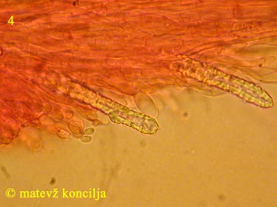 Steccherinum ochraceum - Skeletozystiden