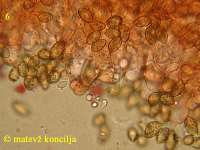 Cortinarius odorifer - Marginalzelle