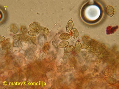 Cortinarius odorifer - marginalne celice