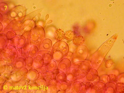 Russula olivacea - cistide