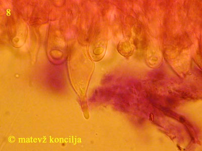 Russula olivacea - cistide