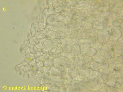 orbilia coccinella - excipulum