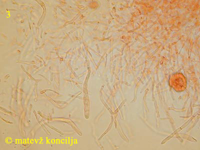 Russula paludosa - Dermatozystiden