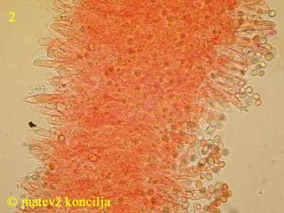 Russula paludosa - cistide na lističu