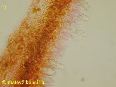 Peniophora piceae - lamprocistide