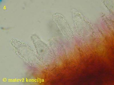 Peniophora piceae - lamprocistide