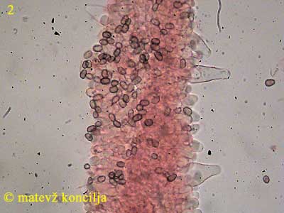 Psathyrella piluliformis - Zystiden