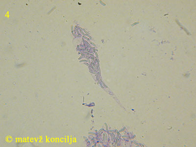 Diatrypella placenta - Ascus