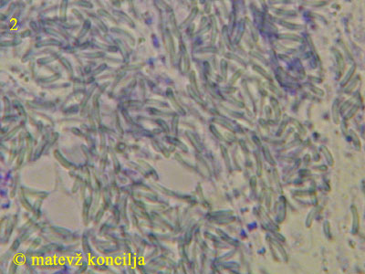 Diatrypella placenta - Sporen