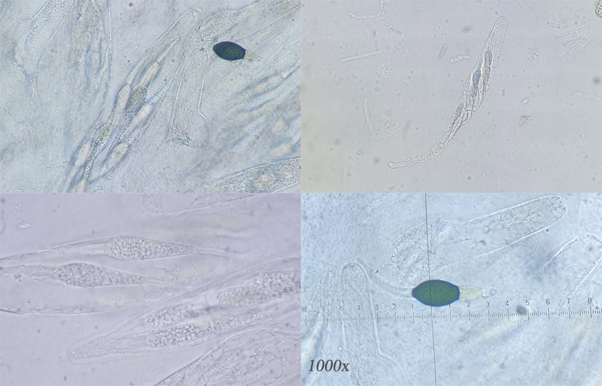 Podospora appendiculata