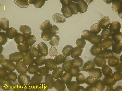 Pucciniastrum areolatum - Aeciosporen