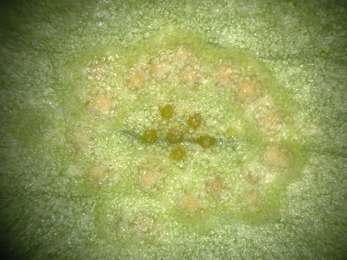 Puccinia sessilis