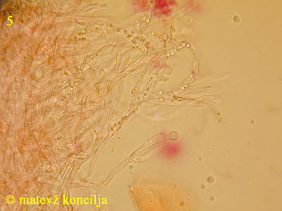 Hyphodontia radula - hife