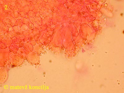 Marasmiellus ramealis - kajlocistide