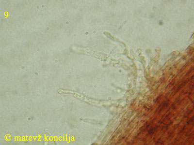 Roridomyces roridus - kavlocistide