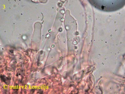 hyphodontia sambuci - leptocistide