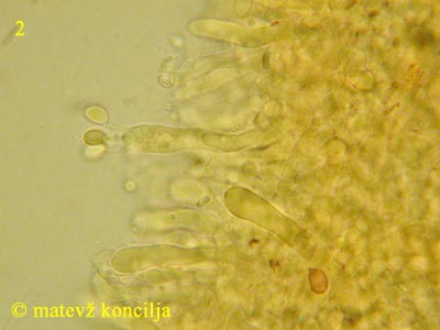 Tricholoma saponaceum - Basidie
