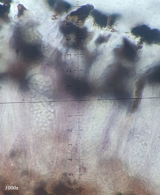 Sarea difformis - Schwarzes Harzbecherchen