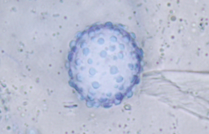 Scutellinia minor