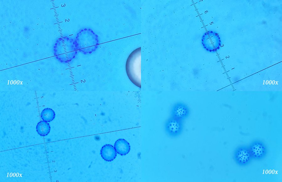 Scutellinia minor