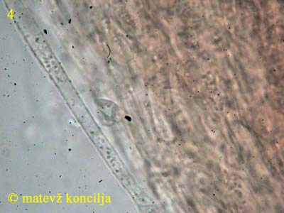 Bonomyces sinopicus - Hutdeckschicht