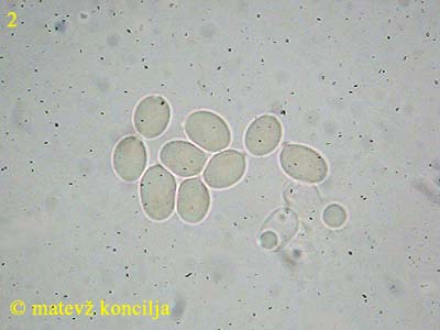 Bonomyces sinopicus - Sporen