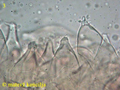 psathyrella spadicea - kajlocistide