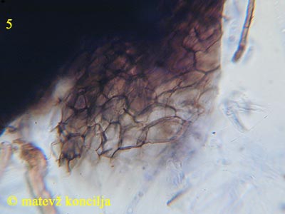 lasiosphaeria spermoides - textura
