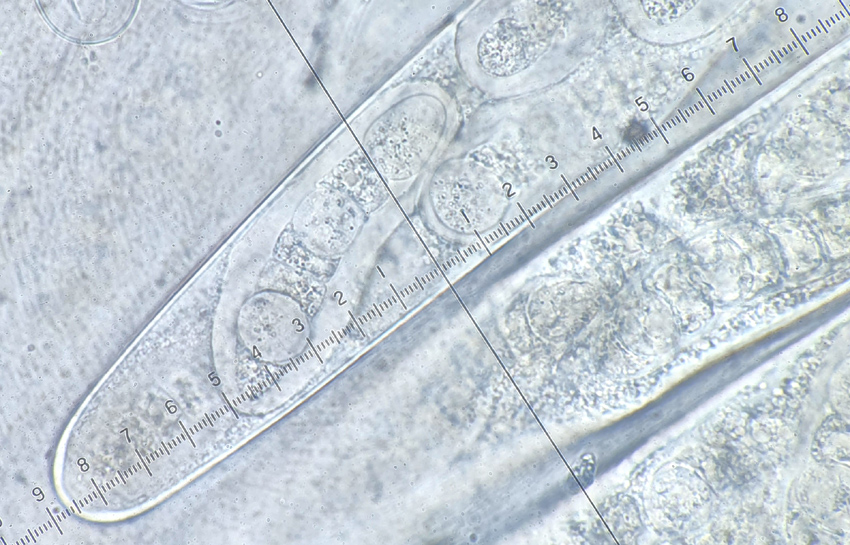 Sporormiella heptamera