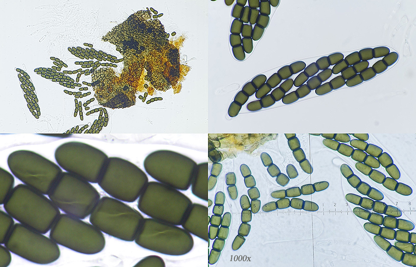 Sporormiella intermedia
