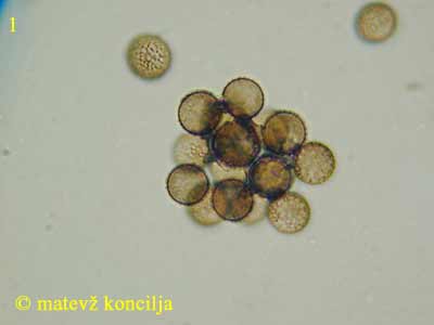 Symphytocarpus amaurochaetoides - Sporen