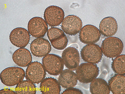 Puccinia taraxaci - Urediniosporen und Teleutospore