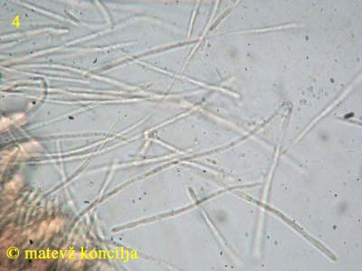 Phaeohelotium umbilicatum - Paraphysen