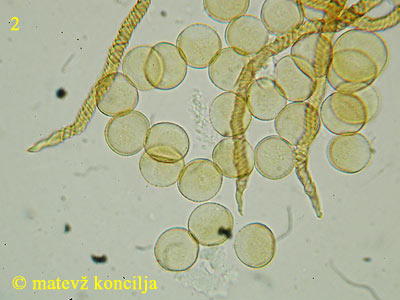 Trichia varia - Sporen und Elateren-Enden