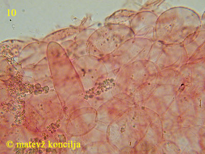 Coprinus velatopruinatus - pileocistide