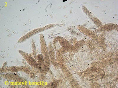 Diatrypella verrucaeformis - Asci