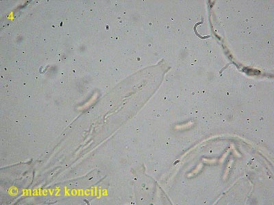 Diatrypella verrucaeformis - Ascus