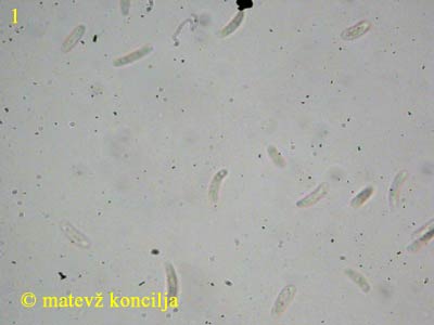 Diatrypella verrucaeformis - Sporen
