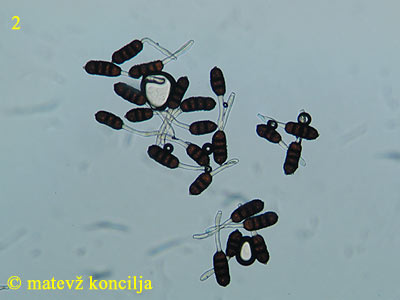 Phragmidium violaceum - Teliosporen