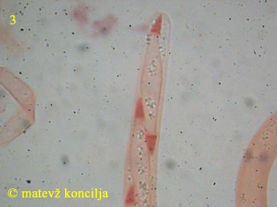 Hypomyces viridis - aski