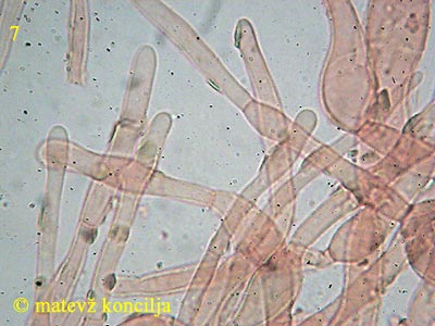 Hypomyces viridis - hife okoli peritecijev