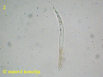 Podophacidium xanthomelum - Ascus