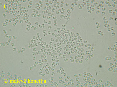Orbilia xanthostigma - Sporen